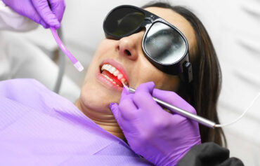 Painless Laser Gum Surgery
