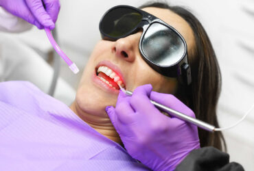 Painless Laser Gum Surgery