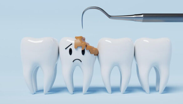 Always thinking How can you prevent dental problems of your child and your family?