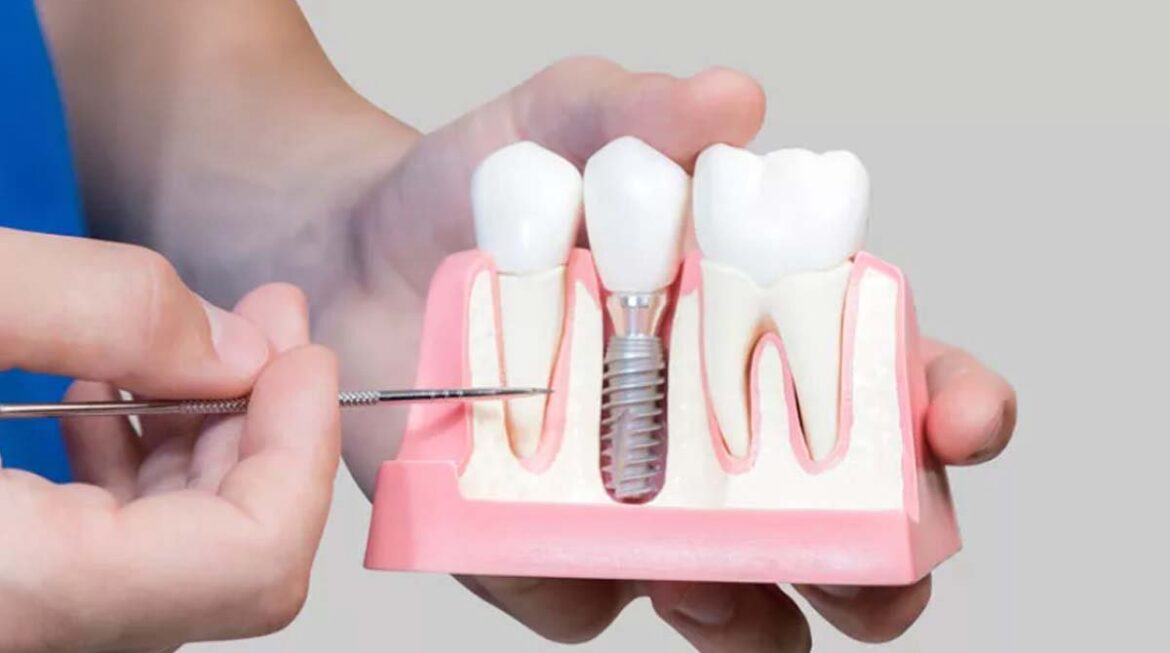 Having fear of dental implants?