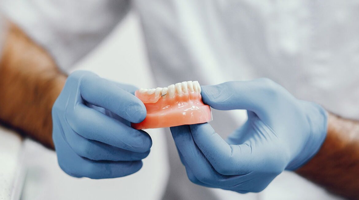 Full Mouth Rehabilitation : Dental Implants VS Dentures