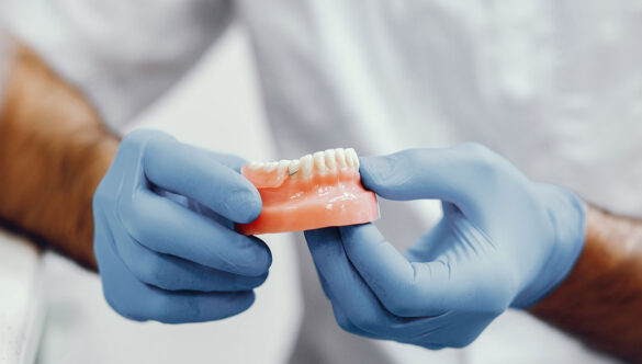 Full Mouth Rehabilitation : Dental Implants VS Dentures