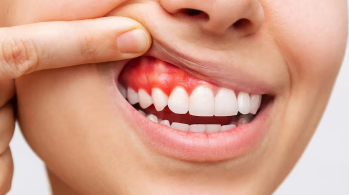 Healthy Teeth & Gums Contribute Significantly to an Overall Healthy Lifestyle in Several Ways
