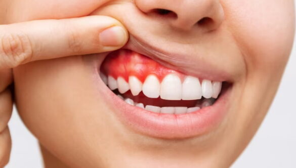 Healthy Teeth & Gums Contribute Significantly to an Overall Healthy Lifestyle in Several Ways