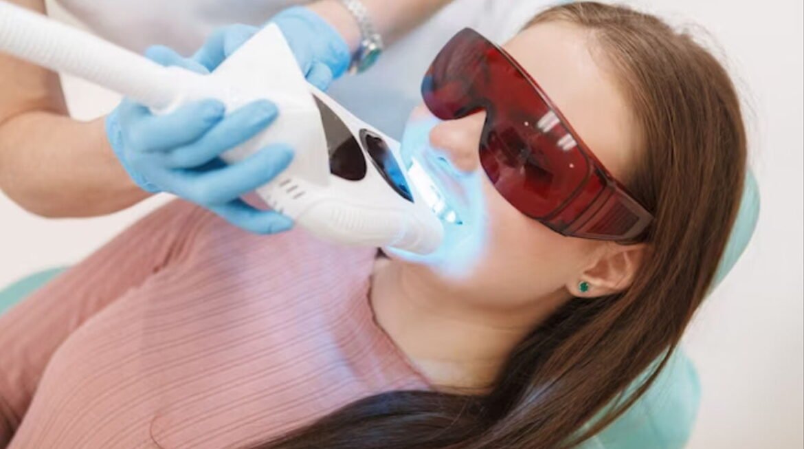 Precision, Care, and Radiance: NOVA Dental Hospital Introduces Laser Teeth Whitening with Minimal Discomfort