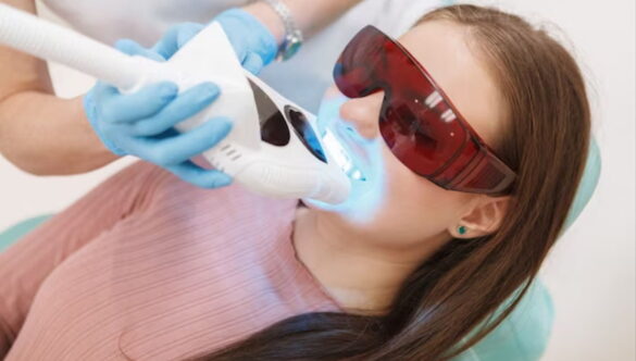 Precision, Care, and Radiance: NOVA Dental Hospital Introduces Laser Teeth Whitening with Minimal Discomfort