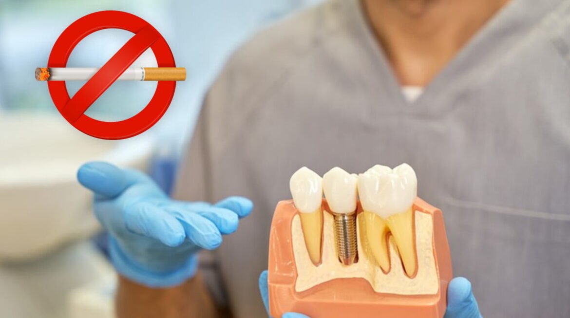 Why Smoking is a Contraindication for Implant Patients – A Closer Look at Oral Health Risks