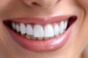 The Importance of Regular Teeth Cleaning Twice in A year for Maintaining a Healthy Smile