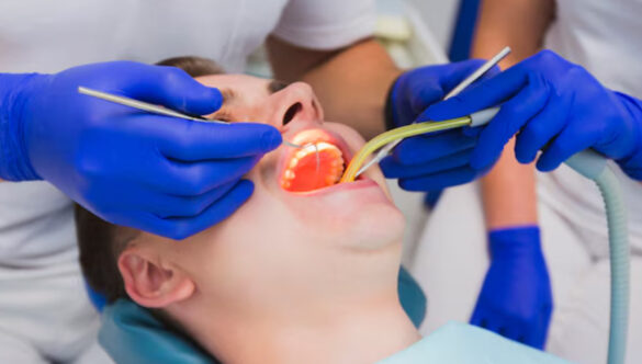 Comprehensive Full-Mouth Rehabilitation in Gandhinagar: Implant-Supported & Tooth-Supported Solutions