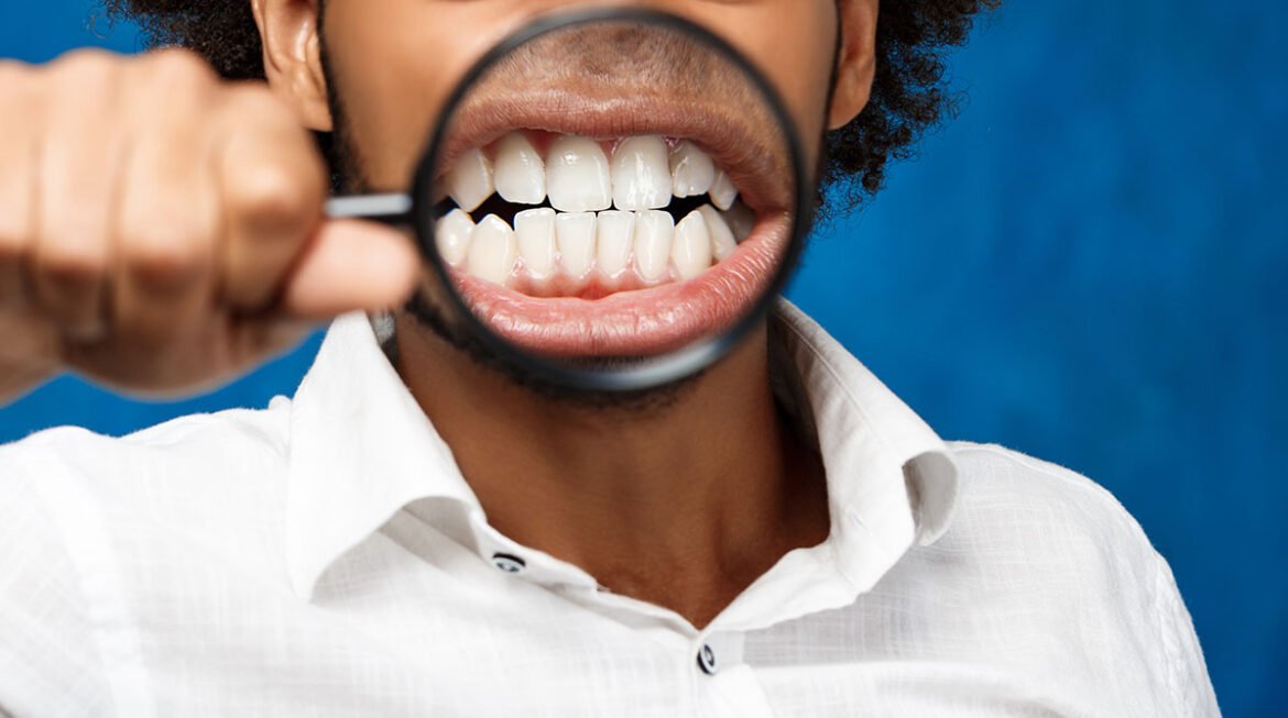 The Truth About Dental Insurance in India and How to Secure Your Oral Health