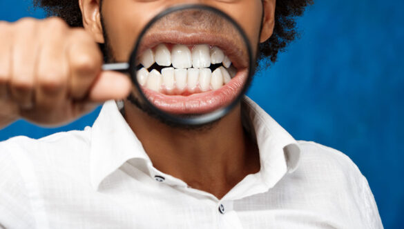 The Truth About Dental Insurance in India and How to Secure Your Oral Health