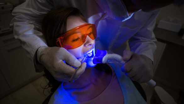 Laser Frenectomy Gandhinagar: A Painless Solution for Tongue and Lip Ties