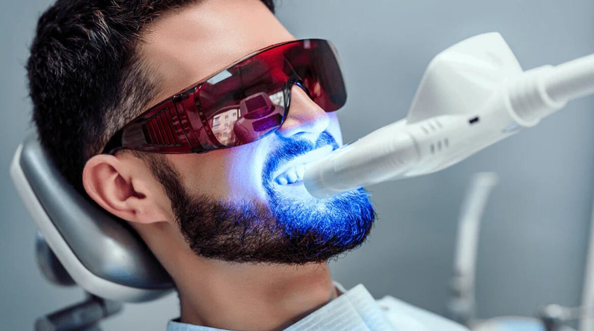 Laser Tooth Whitening Gandhinagar: Achieve a Brighter Smile with Ease