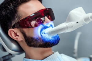 Laser Tooth Whitening Gandhinagar: Achieve a Brighter Smile with Ease