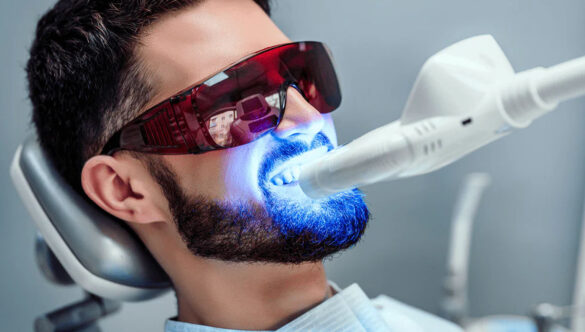Laser Tooth Whitening Gandhinagar: Achieve a Brighter Smile with Ease