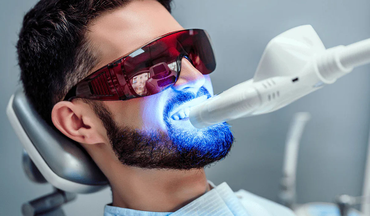 Laser Tooth Whitening Gandhinagar: Achieve a Brighter Smile with Ease