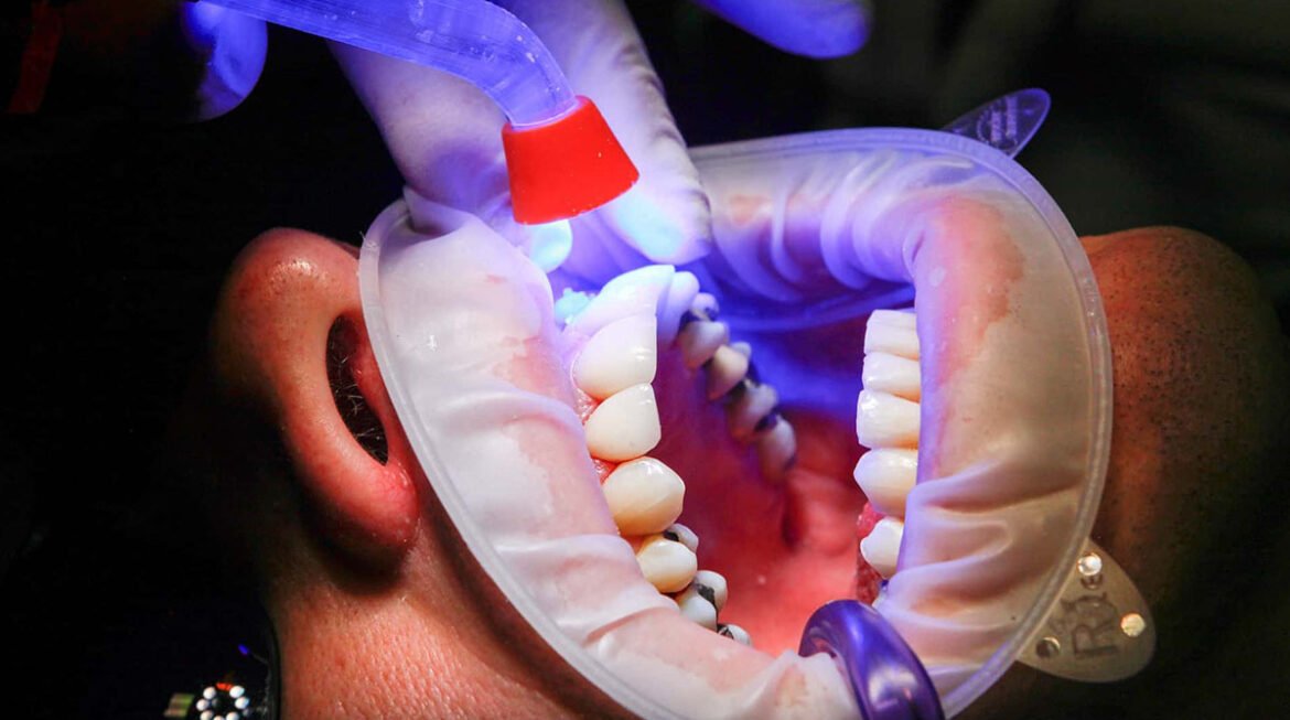 Painless Laser Treatment Gandhinagar: A Modern Approach to Dental Care