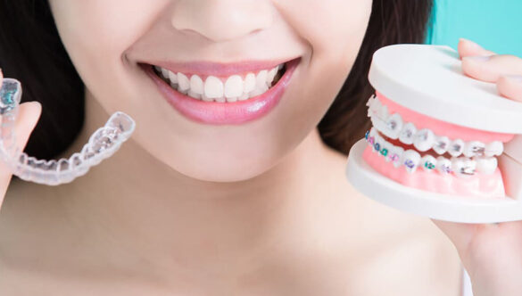 Why Teeth Alignment is Necessary?