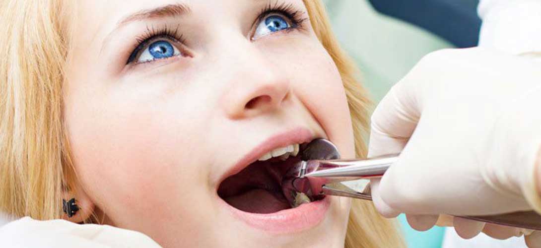 What Can I Expect From a Wisdom Teeth Removal and Recovery?