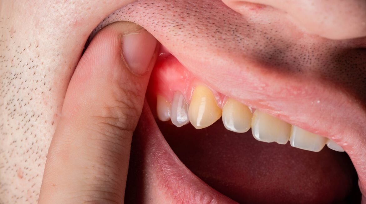 Why Is My Gum Swollen or Tender, and Should I Worry?