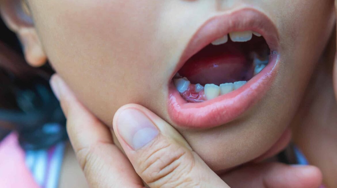 Is It Normal for My Child to Lose Teeth Late?