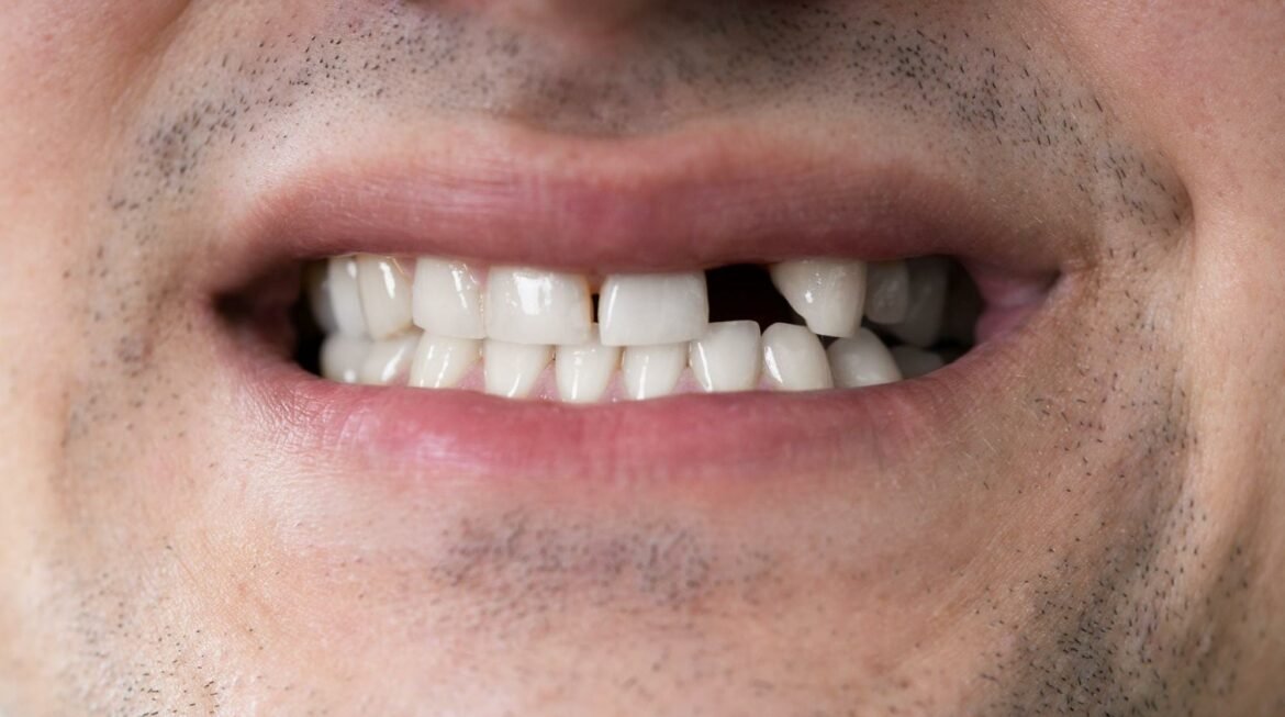 What Can I Do About a Missing Tooth?