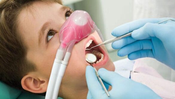 Kids Dentist in Gandhinagar – Laughing Gas (Nitrous Oxide) Sedation for Children’s Dental Treatments (2026)