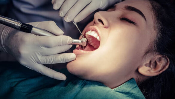 Painless Single-Sitting Root Canal Treatment in Gandhinagar: Complete Guide 2026) – Nova Dental Hospital – The Best Root Canal Specialist in gandhinagar