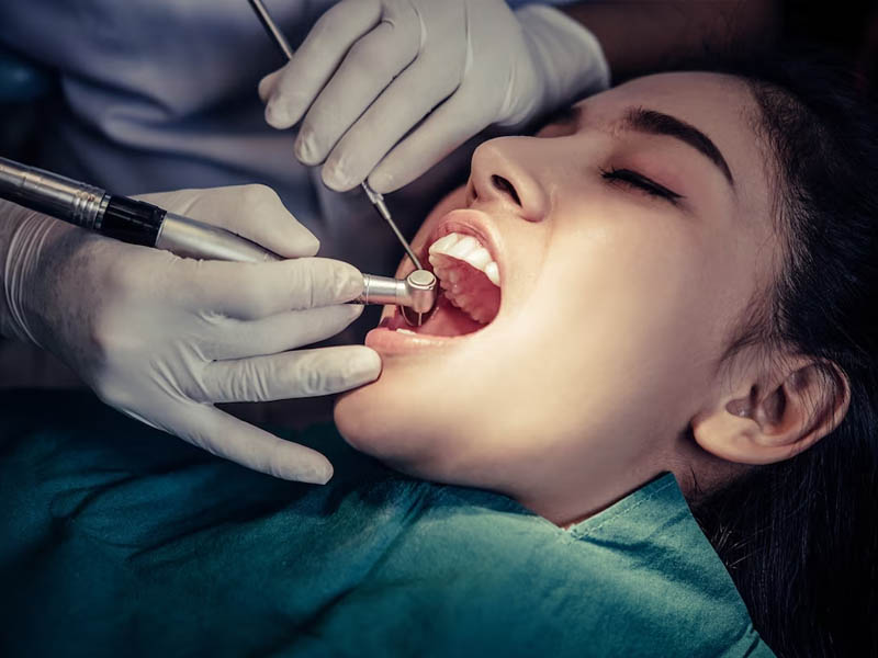 Painless Single-Sitting Root Canal Treatment in Gandhinagar: Complete Guide 2026) – Nova Dental Hospital – The Best Root Canal Specialist in gandhinagar