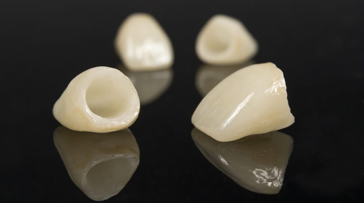 How Long Do Dental Crowns Last? Lifespan, Care & Replacement