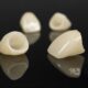 How Long Do Dental Crowns Last? Lifespan, Care & Replacement
