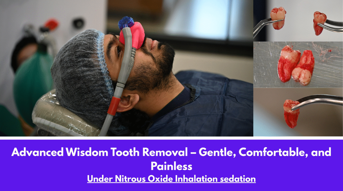 Dental Sedation Options for Anxious Patients: Which One Is Right for Me?