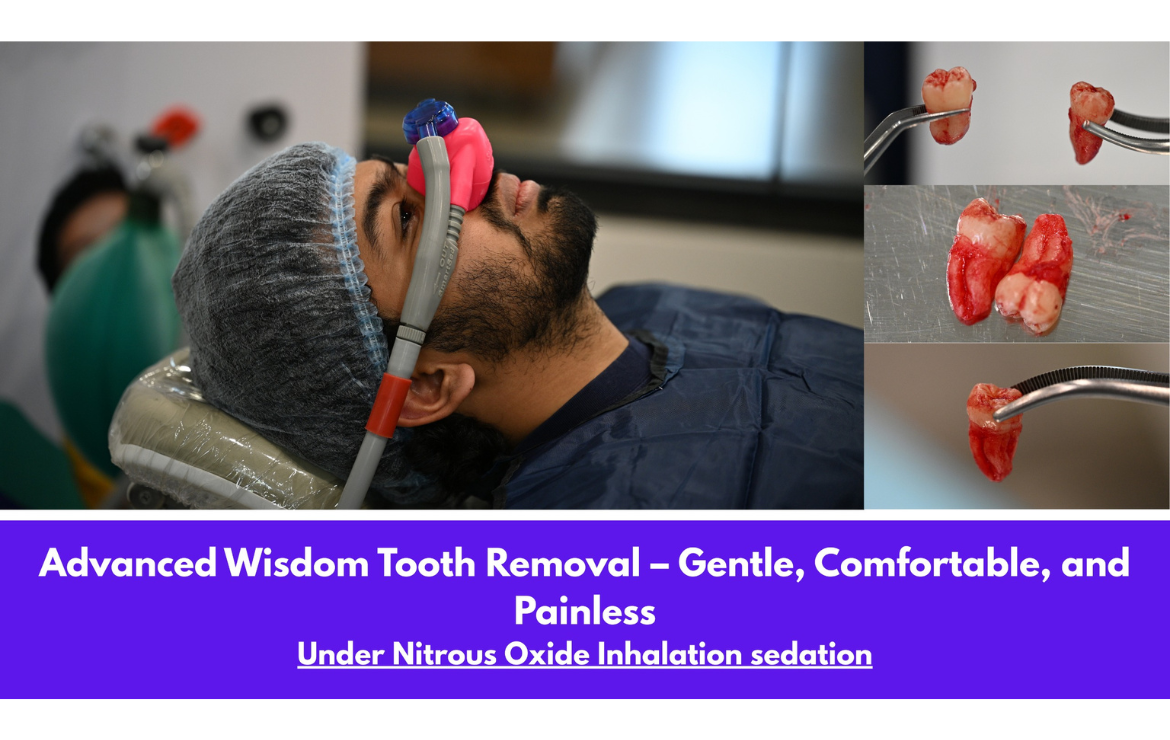 Dental Sedation Options for Anxious Patients: Which One Is Right for Me?