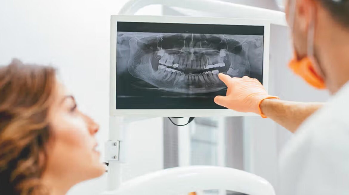 X-rays Before Dental Implants: Using 3D Tech for Success