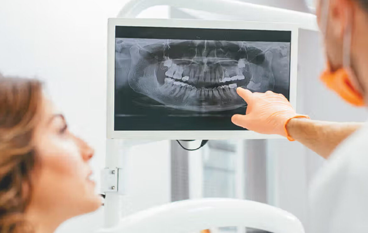 X-rays Before Dental Implants: Using 3D Tech for Success