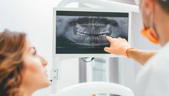 X-rays Before Dental Implants: Using 3D Tech for Success
