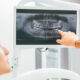 X-rays Before Dental Implants: Using 3D Tech for Success