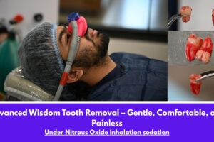 Dental Sedation Options for Anxious Patients: Which One Is Right for Me?