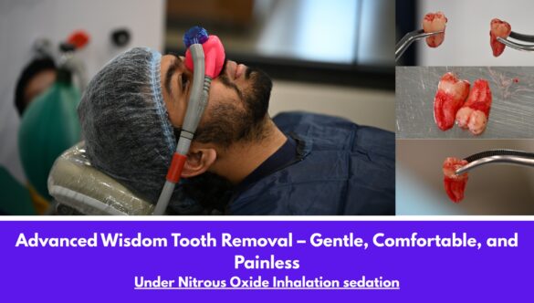 Dental Sedation Options for Anxious Patients: Which One Is Right for Me?