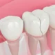 Can a Cracked Tooth Be Saved or Does It Need to Be Extracted?