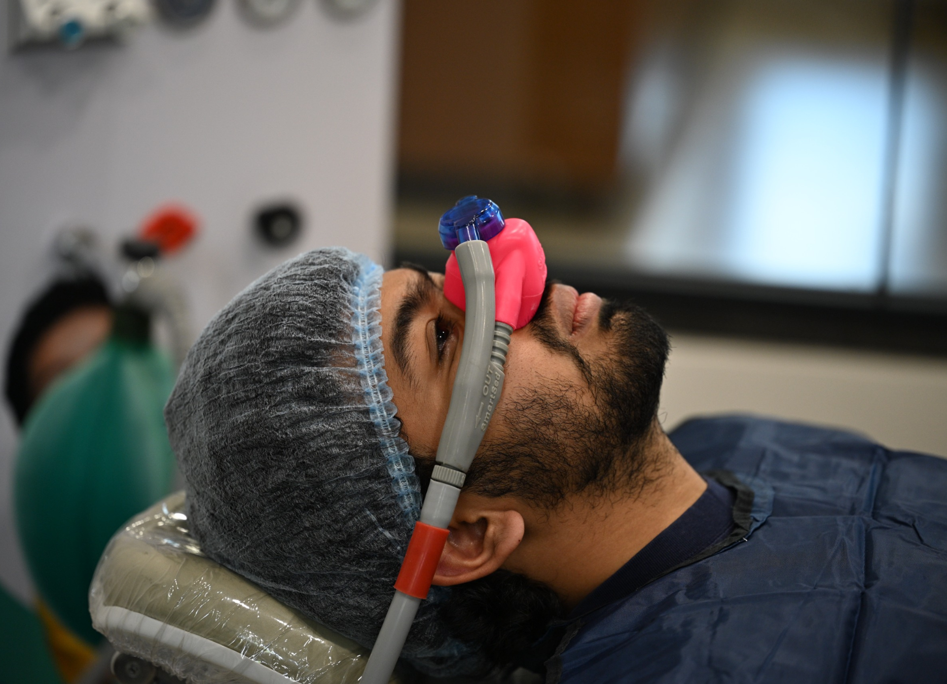 nitrous oxide inhalation sedation for painless dentistry