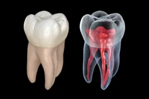 3D Scan for Root Canal: Finding Hidden Canals