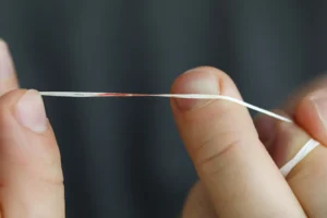 Is It Normal for My Gums to Bleed Every Time I Floss?