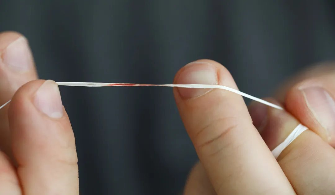 Is It Normal for My Gums to Bleed Every Time I Floss?
