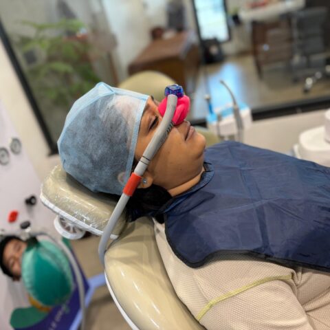 Horizontal wisdom tooth removal under nitrous oxide inhalation sedation