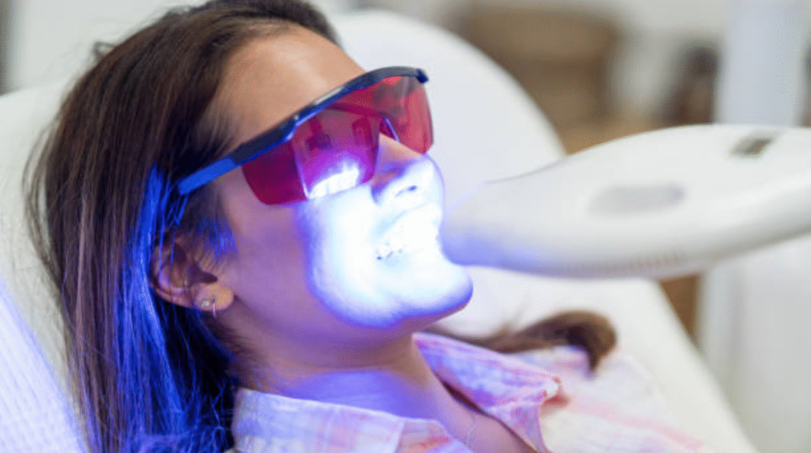Professional Teeth Whitening vs. At-Home Kits: What’s the Real Difference?