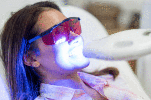 Professional Teeth Whitening vs. At-Home Kits: What’s the Real Difference?