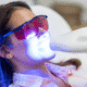 Professional Teeth Whitening vs. At-Home Kits: What’s the Real Difference?