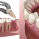Root Canal vs Tooth Extraction: Which Is Actually the Better Choice?