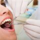 What to Expect at a Dental Check-Up in Gandhinagar at Nova Dental Hospital, Gandhinagar